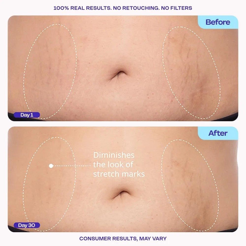 Firm & smooth belly cream